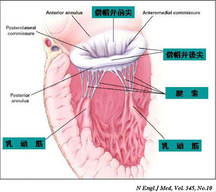 僧帽弁閉鎖不全症